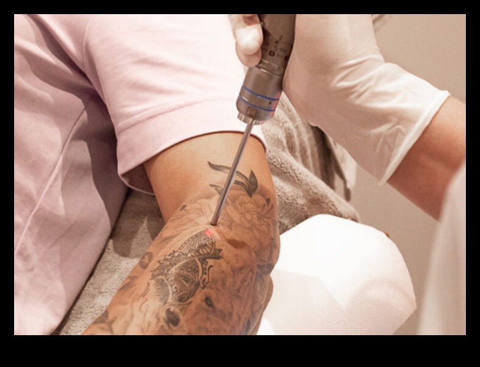 Ace de precizie: explorarea metodelor de tatuaj de ultimă oră